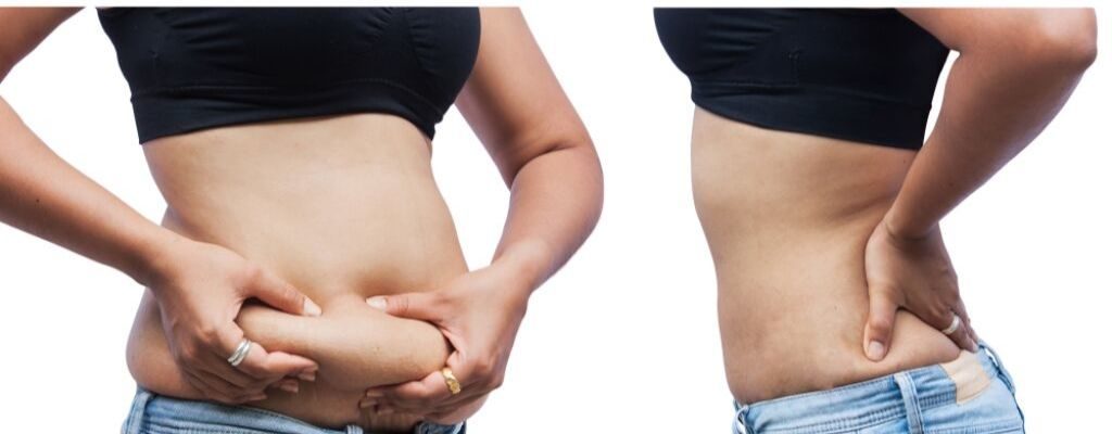 woman pinching belly fat before and after 